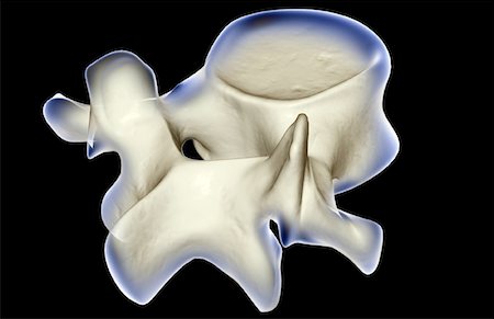 spinous process - Lumbar vertebra Stock Photo - Premium Royalty-Free, Code: 671-02099251