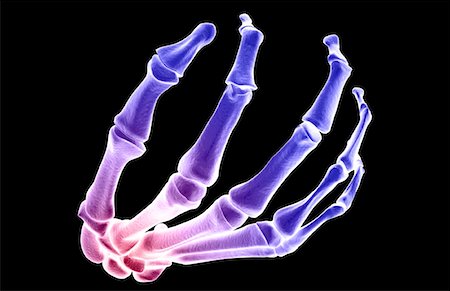 proximal phalanx - The bones of the hand Stock Photo - Premium Royalty-Free, Code: 671-02092273