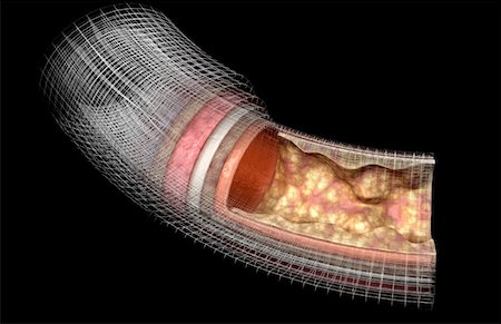 Der Arterienwand Stockbilder - Premium RF Lizenzfrei, Bildnummer: 671-02100512