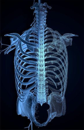 simsearch:671-02092292,k - Nerves of the upper body Stock Photo - Premium Royalty-Free, Code: 671-02100691