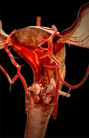 simsearch:671-02102563,k - The arteries of the female reproductive system Foto de stock - Royalty Free Premium, Número: 671-02101496