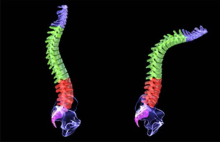 Spondylitis Foto de stock - Sin royalties Premium, Código: 671-02101756