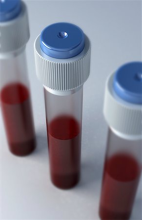 Blood samples Stock Photo - Premium Royalty-Free, Code: 671-02102546