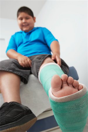 Boy with leg in plaster cast Foto de stock - Sin royalties Premium, Código: 694-03331595