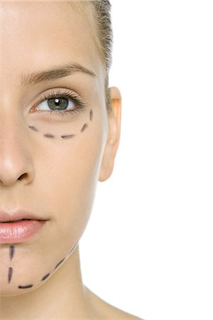 plastic surgery woman face - Woman with plastic surgery markings on face, close-up, cropped view Stock Photo - Premium Royalty-Free, Code: 695-05768234