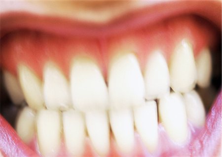 simsearch:693-06324094,k - Woman's teeth, extreme close-up, blur Stock Photo - Premium Royalty-Free, Code: 695-05773310