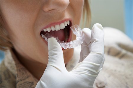 simsearch:693-06014951,k - Woman having dental mold fitted, (close-up) Stock Photo - Premium Royalty-Free, Code: 693-06014951