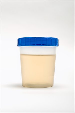 Échantillon d'urine dans le pot en plastique Photographie de stock - Premium Libres de Droits, Code: 693-06021963