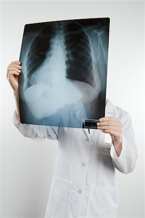 doctor looking at xray - Doctor with xray covering face Stock Photo - Premium Royalty-Free, Code: 693-06021989