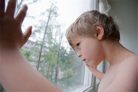 Boy with Chicken Pox Looking Out Window Foto de stock - Con derechos protegidos, Código: 700-05969973