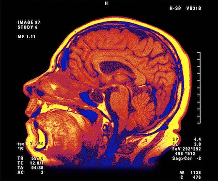 M.R.I. Brain Scan Stock Photo - Rights-Managed, Code: 700-00026692