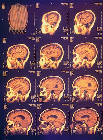 MRI Composite Image of Brain Stock Photo - Rights-Managed, Code: 700-00021522