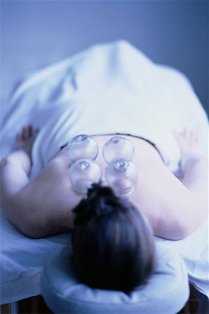 simsearch:700-00087311,k - Woman Having Cupping Procedure On Back Foto de stock - Con derechos protegidos, Código: 700-00078320