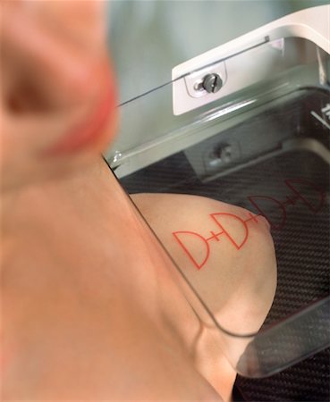Close-Up of Woman Having Mammogram Foto de stock - Con derechos protegidos, Código: 700-00079390