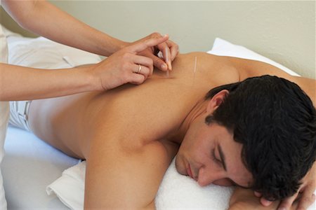 simsearch:700-02071800,k - Acupuncture Stock Photo - Rights-Managed, Code: 700-00609547