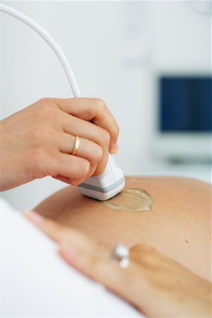 simsearch:700-00281356,k - Pregnant Woman Having Ultrasound Stock Photo - Rights-Managed, Code: 700-00639468