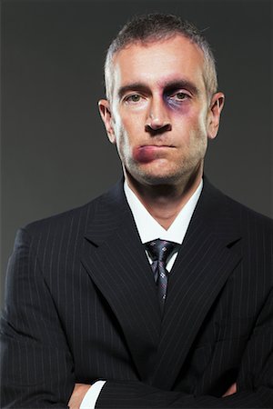 simsearch:700-03075946,k - Portrait of Bruised Businessman Stock Photo - Rights-Managed, Code: 700-00748028