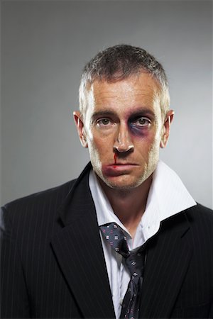 face men rough - Injured Businessman Stock Photo - Rights-Managed, Code: 700-00748039