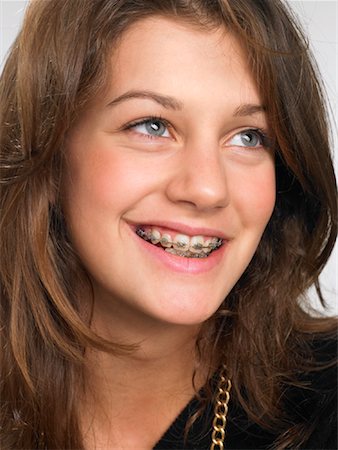 Portrait of Teenaged Girl With Braces Stock Photo - Rights-Managed, Code: 700-01185067
