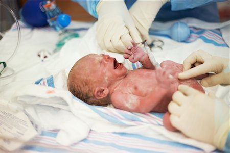 Doctors Tending to Newborn Baby Foto de stock - Con derechos protegidos, Código: 700-01275335