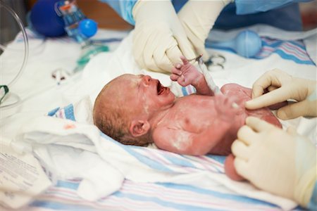 simsearch:700-00592340,k - Doctors Tending to Newborn Baby Stock Photo - Rights-Managed, Code: 700-01275335