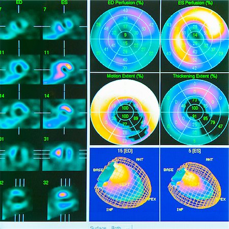 scientific data - Cardiac Scan Data on Computer Display Monitor Foto de stock - Con derechos protegidos, Código: 700-03502790