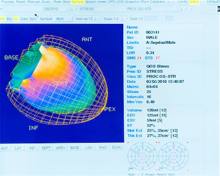 statistics - Cardiac Scan Data on Computer Display Monitor Foto de stock - Con derechos protegidos, Código: 700-03502791