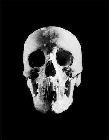 skull bones - 1930s HEAD ON PORTRAIT HUMAN SKULL Stock Photo - Rights-Managed, Code: 846-02793037