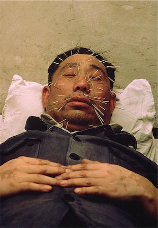 simsearch:841-03058080,k - Man with many acupuncture needles in face, Beijing, China, Asia Foto de stock - Direito Controlado, Número: 841-02923971